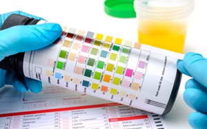 urine test lab clinical medex schedule within hours form give request fill call